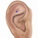 Alivie o Stress com Acupuntura Auricular